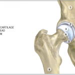 Anatomy of the Hip